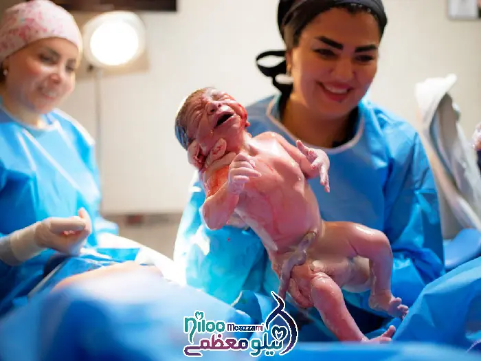 زایمان طبیعی