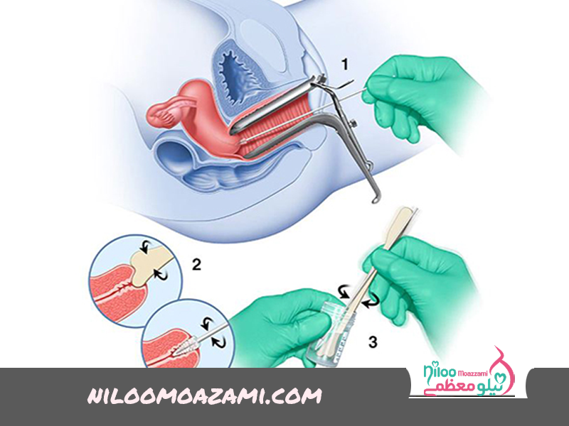 پاپ اسمیر