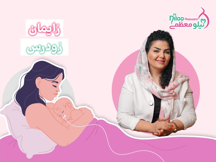 زایمان زودرس