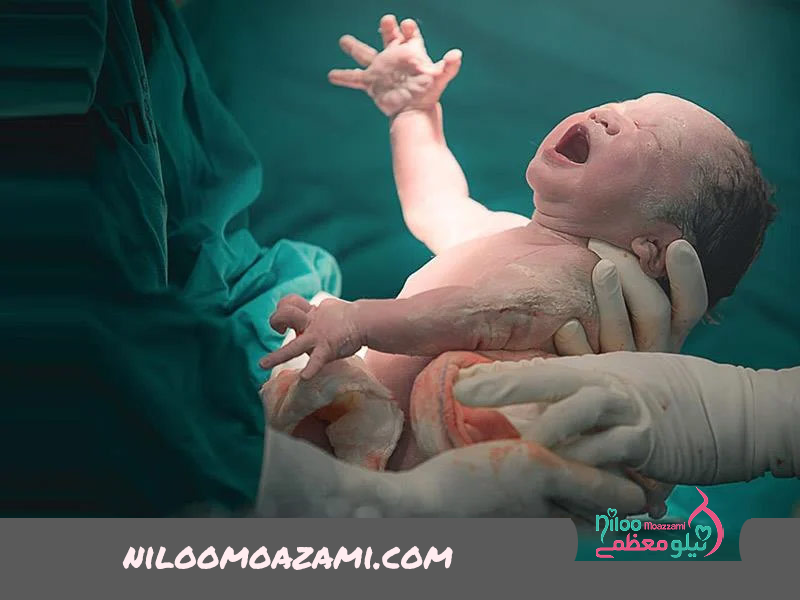 نقش مرد در زمان زایمان
